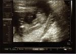 Still think its a boy??? I had a different ultrasound tech and a different machine with this one