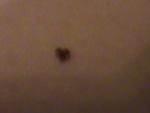 Heart shaped mole on my stomach. I never noticed it before tonight. 